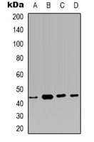 CA12 / Carbonic Anhydrase XII Antibody (Internal)