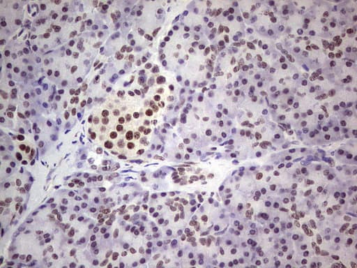 Monoclonal Mouse anti-Human ERCC1 Antibody (clone OTI2H1, IHC, WB)