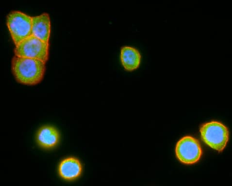 Monoclonal Mouse anti-Human GPR49 / LGR5 Antibody (clone OTI2H7, aa250-550, IHC, IF, WB)