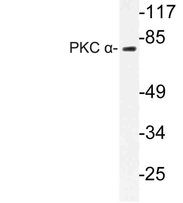 PRKCA / PKC-Alpha Antibody (Glu653)