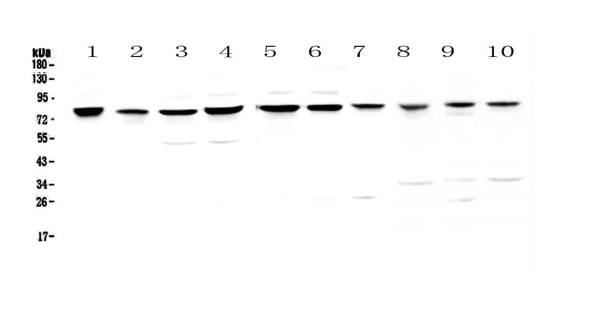 PARN Antibody