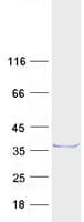 Human RYBP Protein (Recombinant Myc-DDK (Flag))