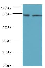 Polyclonal Rabbit anti-Human SMYD4 Antibody (aa1-260, IHC, WB)