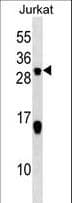 Polyclonal Rabbit anti-Human SCG10 / STMN2 Antibody (aa145-173, WB)