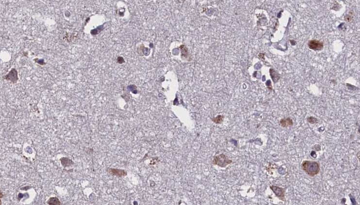 AQP4 / Aquaporin 4 Antibody