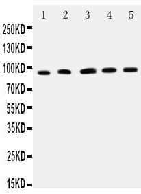 ICAM-1 / CD54 Antibody (aa198-537)