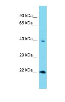 RNF113A Antibody (aa53-102)