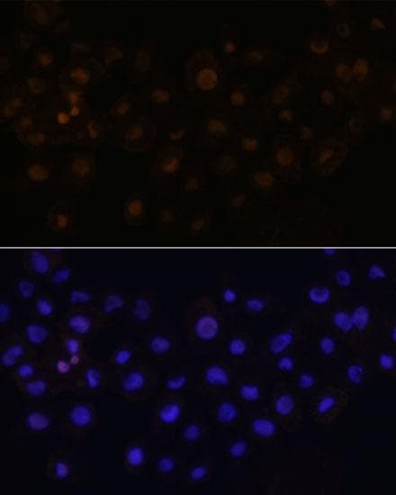 HEY1 Antibody