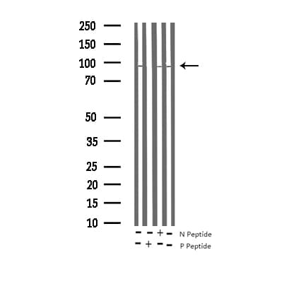 Polyclonal Rabbit anti-Human MAPT / Tau Antibody (phospho-Thr212, IHC, WB)