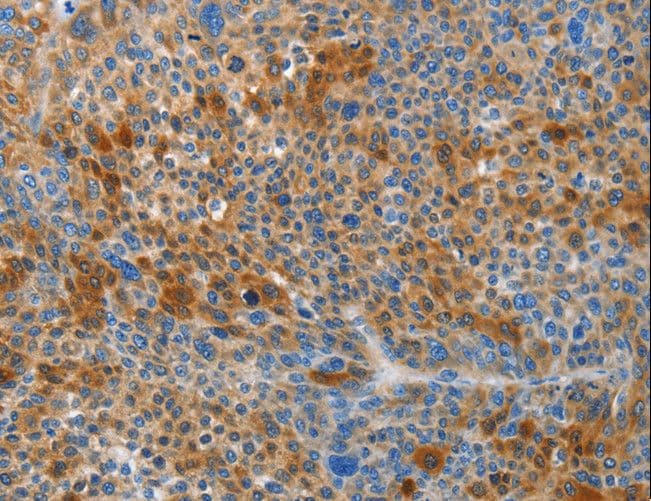 HTRA3 Antibody
