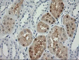 NUDEL / NDEL1 Antibody (clone OTI5E11)