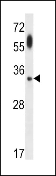 APG5 / ATG5 Antibody