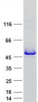 Human INPP5A Protein (Recombinant Myc-DDK (Flag))
