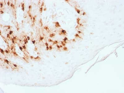 PathPlus™ MLANA / Melan-A Antibody (clone MLANA/1761R)