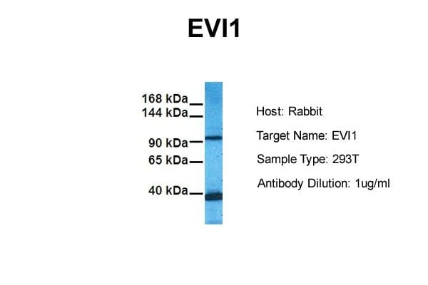 Polyclonal Rabbit anti-Human MECOM / EVI1 Antibody (aa964-1013, IHC, WB)