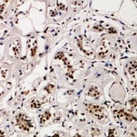 HIRA Antibody