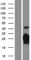 CDKN1B / p27 Kip1 Protein (Over-Expression Lysate Myc-DDK (Flag))