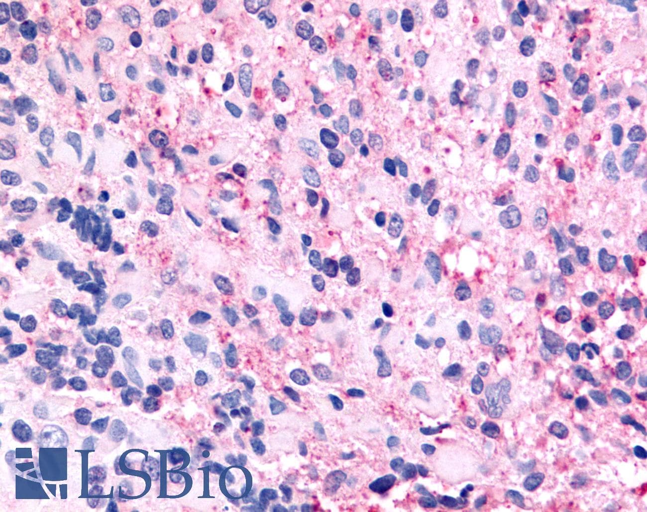 PathPlus™ Polyclonal Rabbit anti-Human GPR45 Antibody (Cytoplasmic Domain, IHC)