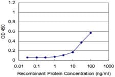 IHC-plus™ Monoclonal Mouse anti-Human RHOA Antibody (clone 1B12, IHC, IF, WB)