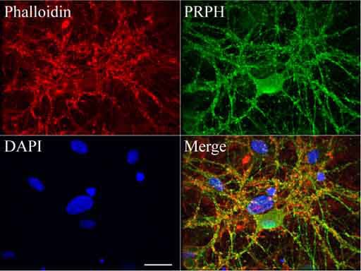 Peripherin Antibody (clone UMAB202, Carrier-free)