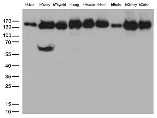 PECAM-1 / CD31 Antibody (clone UMAB29)