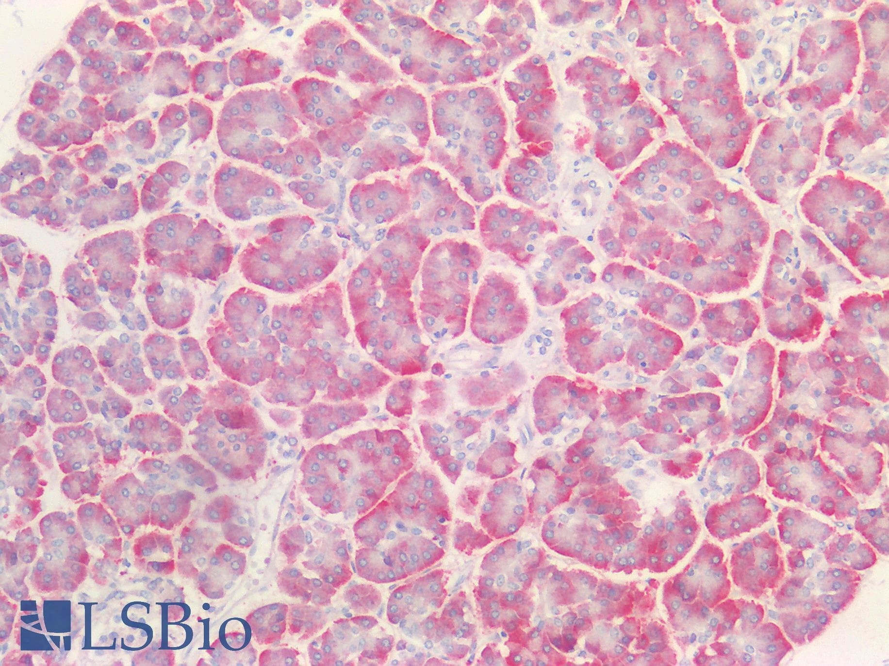 FGL1 / Hepassocin Antibody (aa23-312)