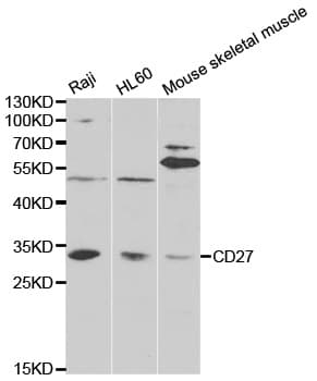 CD27 Antibody