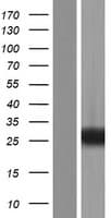 RAB39 / RAB39A Protein (Over-Expression Lysate Myc-DDK (Flag))