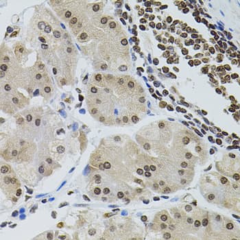 SOCS1 Antibody
