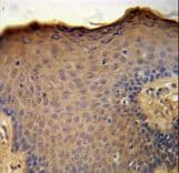 Polyclonal Rabbit anti-Human CXCL9 / MIG Antibody (aa96-122, IHC, WB)