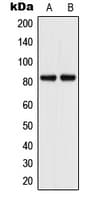 Polyclonal Rabbit anti-Human VCAM1 / CD106 Antibody (Internal, WB)