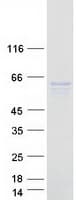 Human C6orf118 Protein (Recombinant Myc-DDK (Flag))