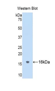 Cystatin SA / CST2 Antibody (aa21-141)