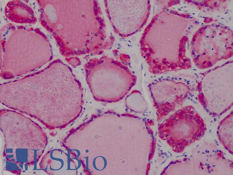 IHC-plus™ PRDX1 / Peroxiredoxin 1 Antibody
