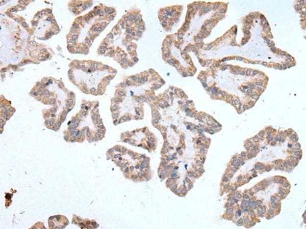 ALDP / ABCD1 Antibody