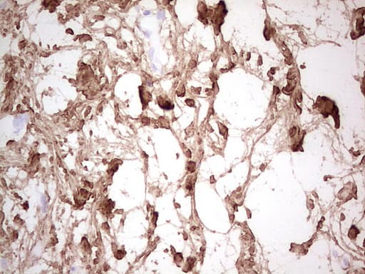 CSNK1G1 / CKI-Gamma 1 Antibody (aa163-422, clone OTI4D9)