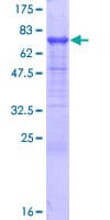 Human TAPBPL / TAPBPR Protein (Recombinant GST)