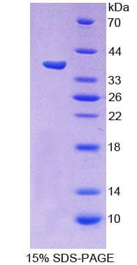 Human PCDHB15 Protein (Recombinant His-T7)