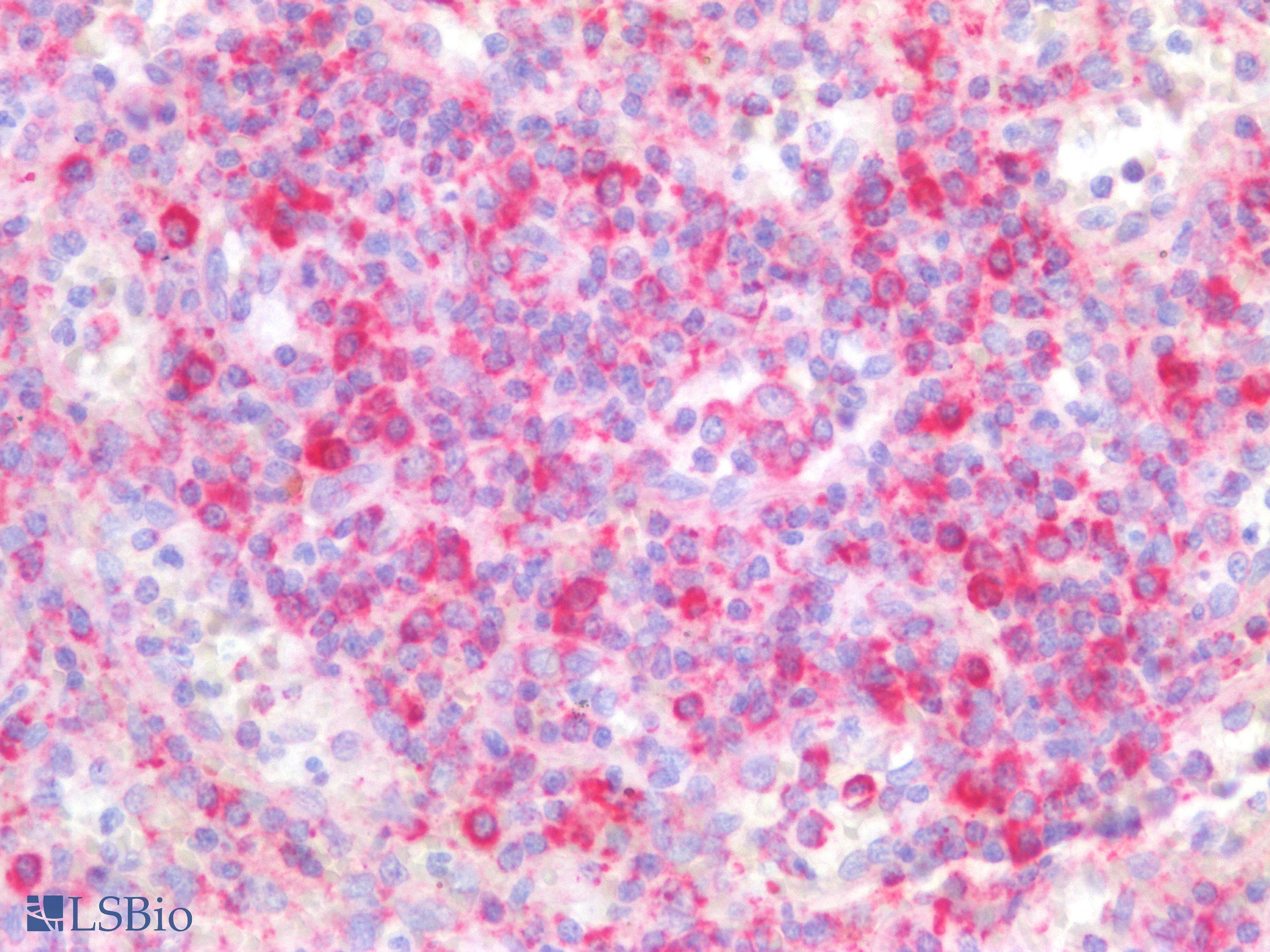 PathPlus™ MTDH / Metadherin Antibody (aa70-582, clone OTI1E7)