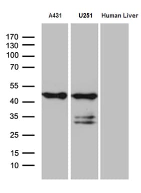 SMAP2 Antibody (clone OTI9B6, Carrier-free)