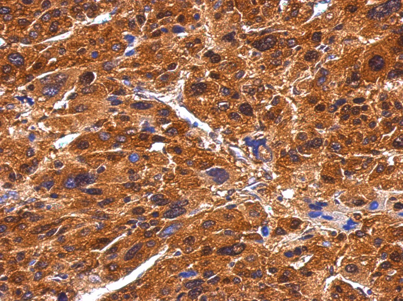 Polyclonal Rabbit anti-Human BIVM Antibody (aa439-503, IHC, WB)