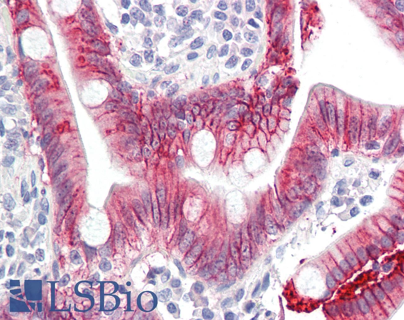 PathPlus™ Monoclonal Mouse anti-Human IL17A Antibody (clone 4K5F6, aa1-75, IHC, WB)