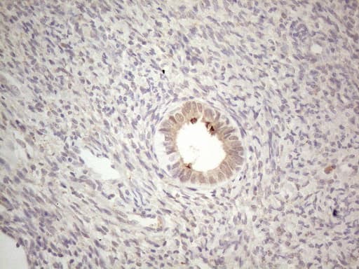 ABCC5 / MRP5 Antibody (clone OTI2C8, Carrier-free)