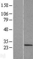 TRIM48 / RNF101 Protein (Over-Expression Lysate Myc-DDK (Flag))