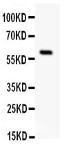 SSTR1 Antibody (aa361-381)