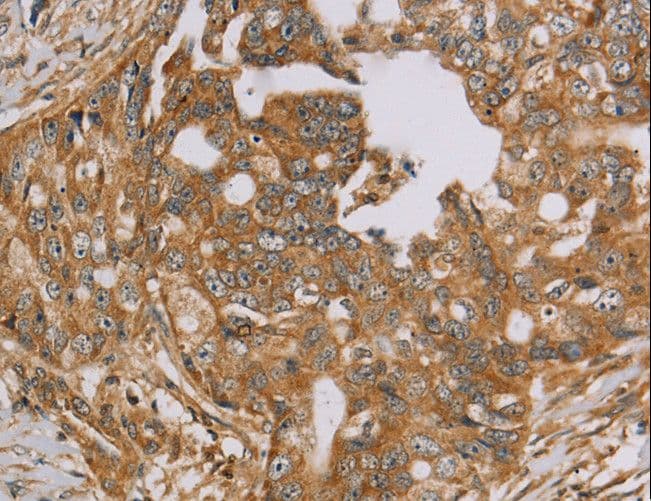 NDUFA10 Antibody