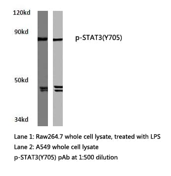 STAT3 Antibody (phospho-Tyr705)