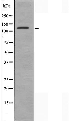 ADAMTS18 Antibody