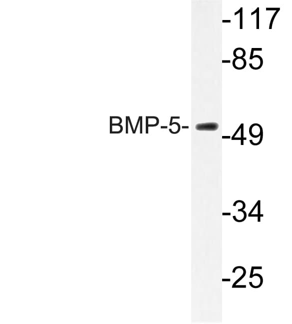 BMP5 Antibody (aa114-163)