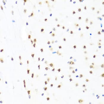 GATA2 Antibody